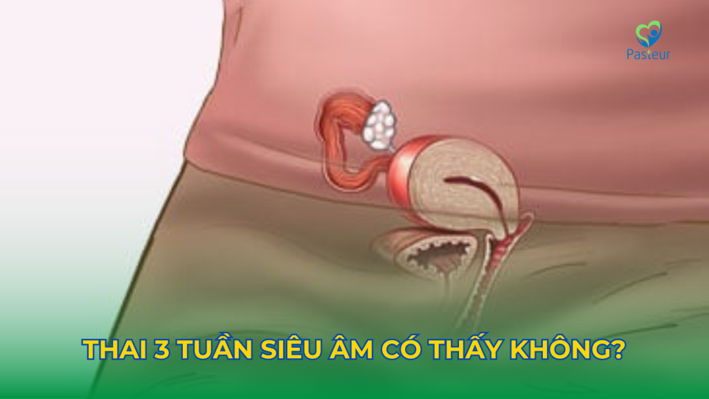 Hình ảnh minh họa thai 3 tuần siêu âm có thấy không