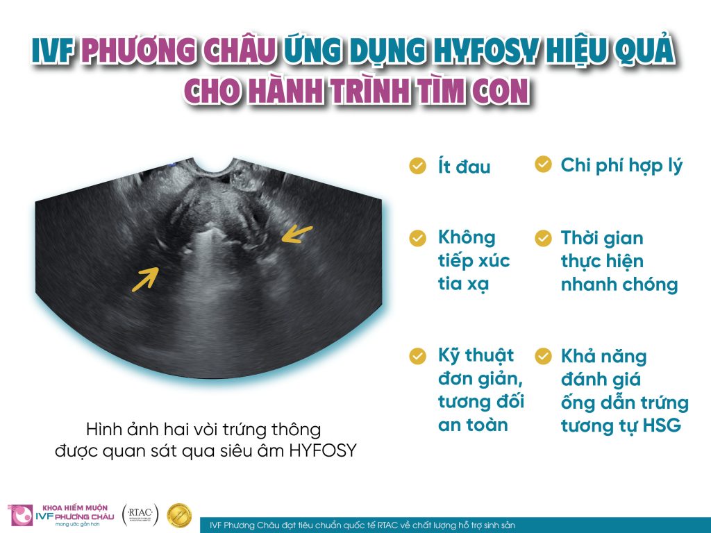 chi phí chụp hsg