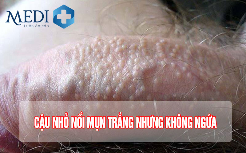 Thông tin chi tiết về dương vật nổi mụn