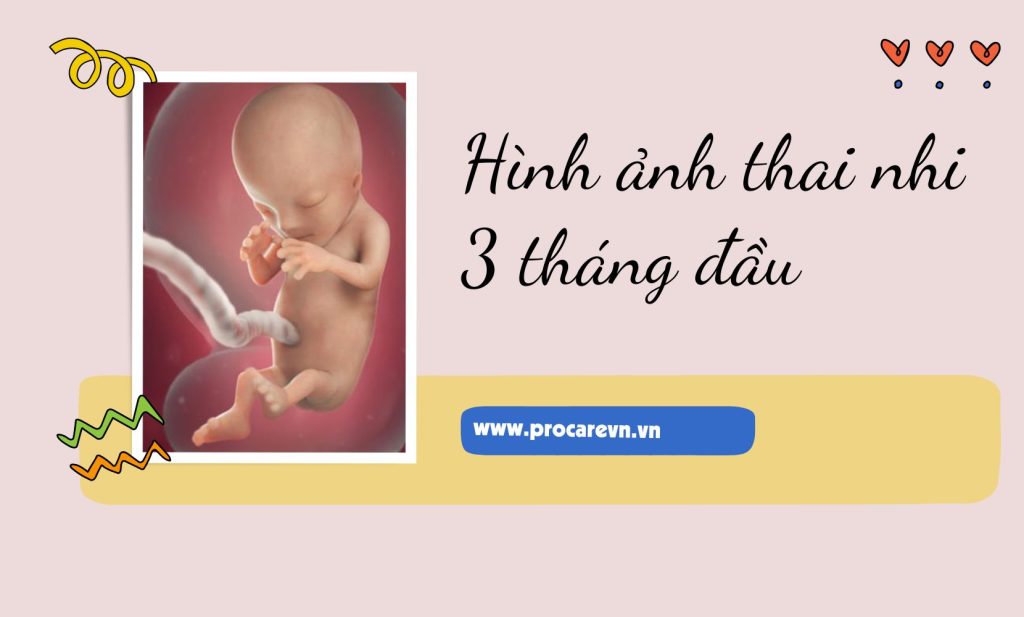 phá thai 3 tháng rưỡi