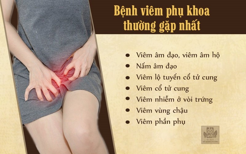 Hình ảnh minh họa dấu hiệu viêm nhiễm phụ khoa