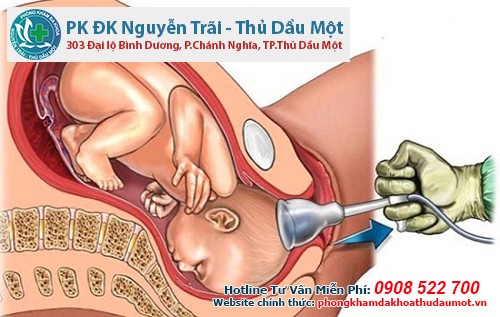 Phương pháp phá thai 3 tháng rưỡi an toàn được bác sĩ áp dụng tại phòng khám