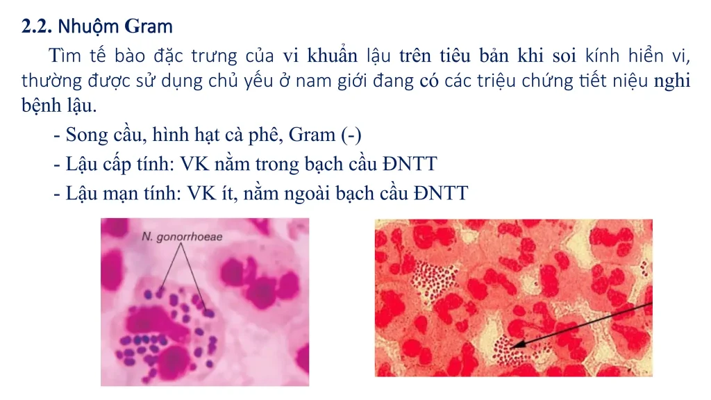 xét nghiệm bệnh lậu mãn tính