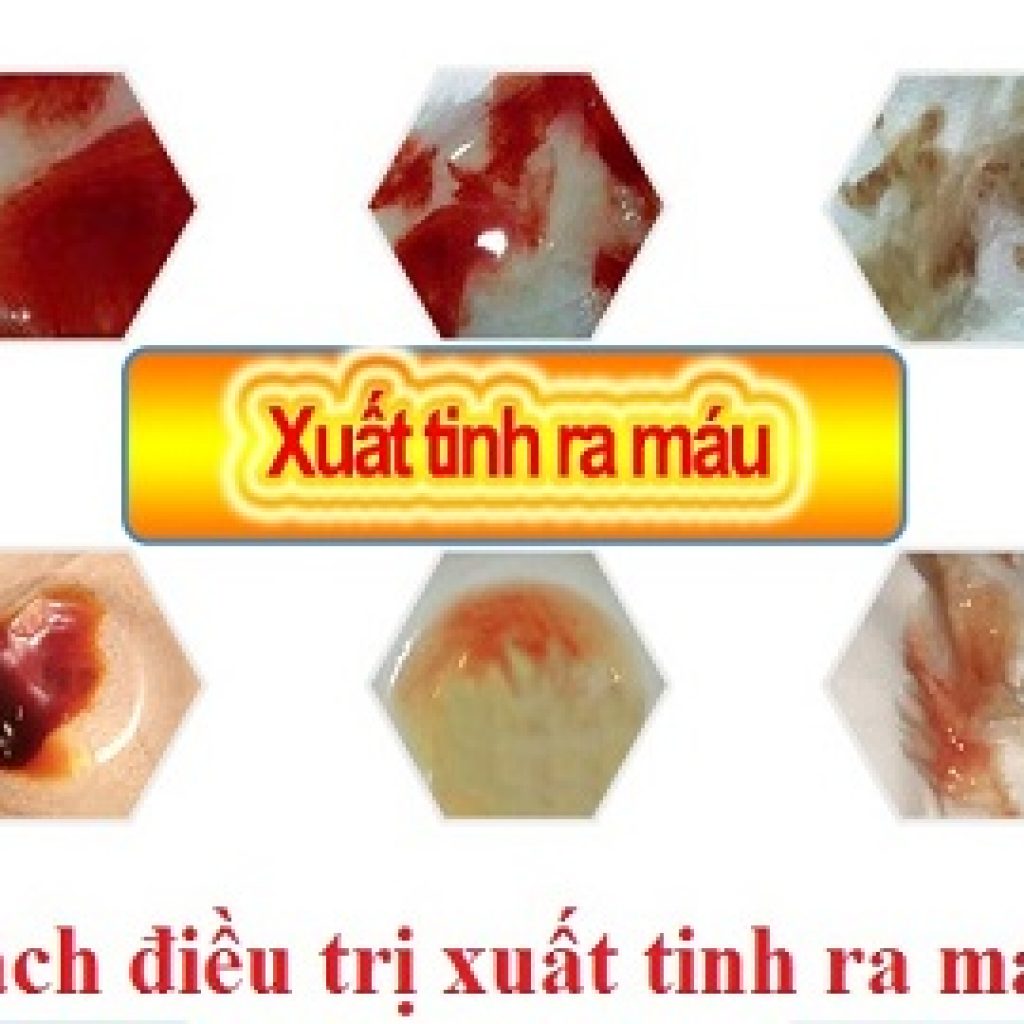 xuất tinh ra máu