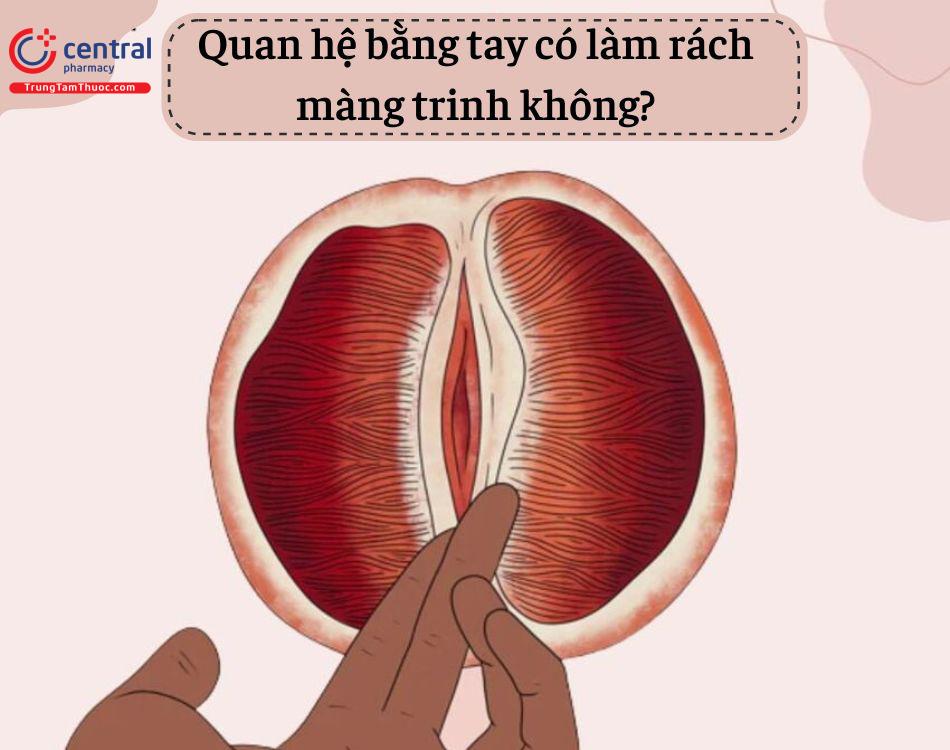 Hình ảnh minh họa nhận biết màng trinh còn hay rách