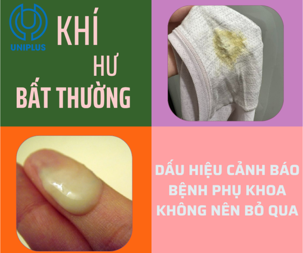khí hư bất thường