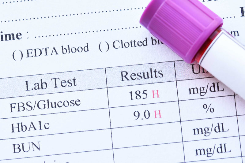 Thông tin chi tiết về lượng glucose trong máu bình thường
