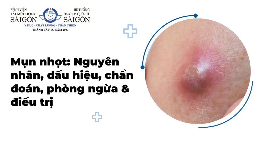 trị mụn nhọt vùng kín