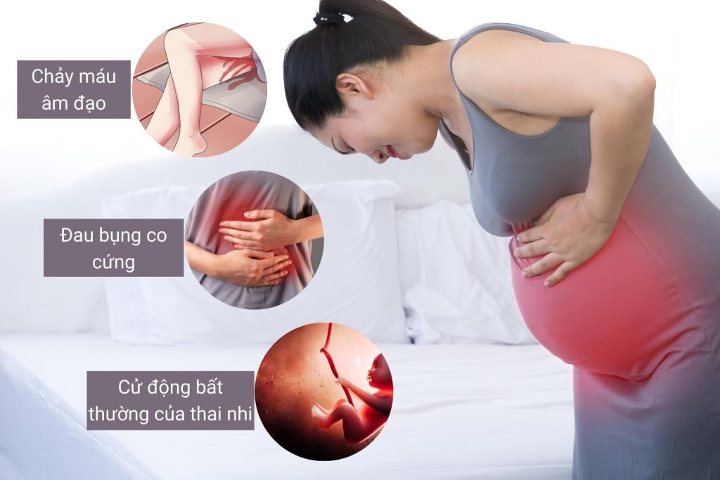 Hình ảnh minh họa đấm vào bụng có sảy thai không