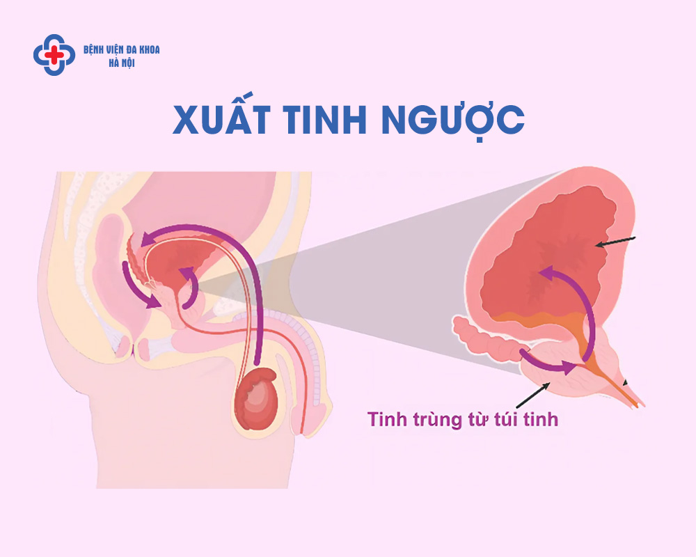 Hình ảnh minh họa xuất tinh ngược