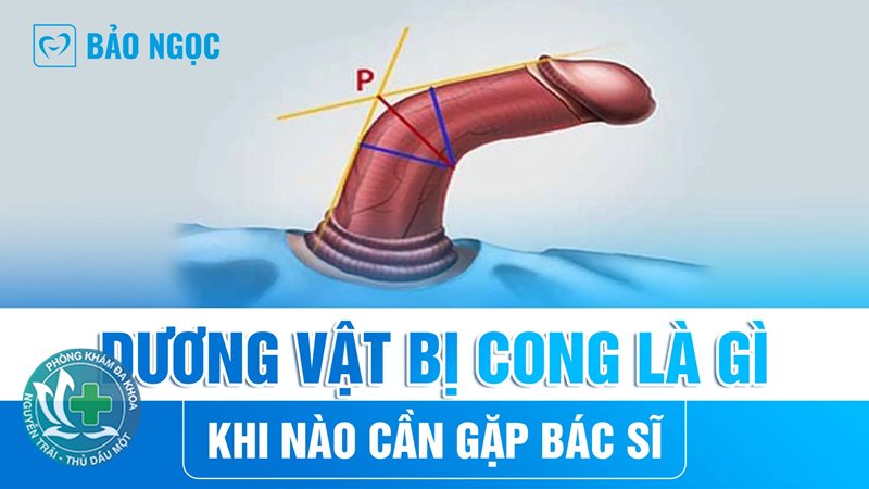 cắt bao quy đầu có đau không - Mức độ đau trong những giờ đầu sau thủ thuật