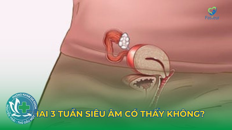 đau bụng kinh dữ dội