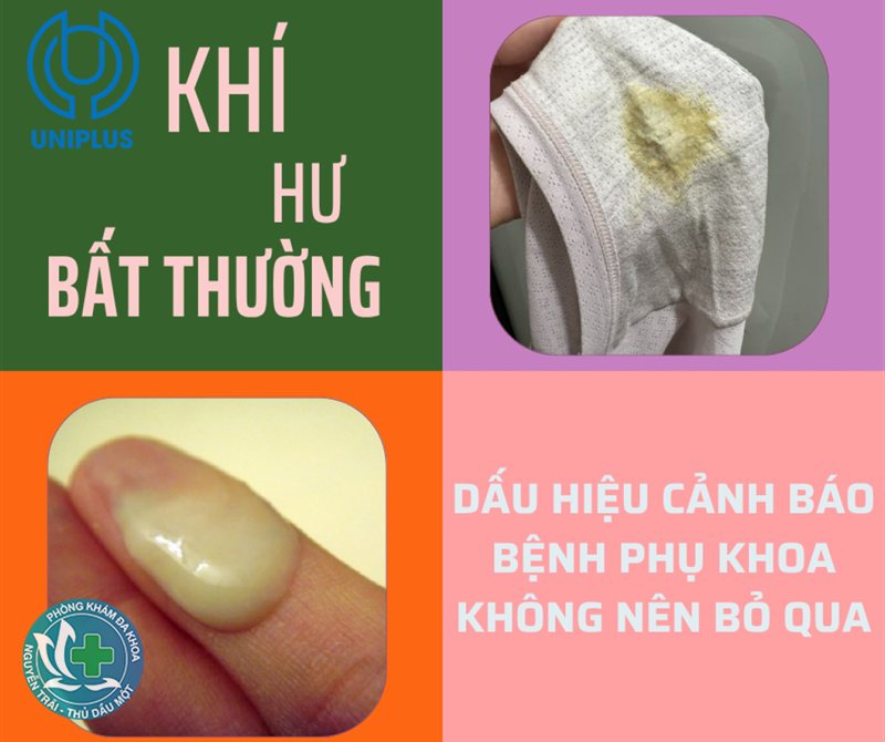 đau bụng kinh nên uống gì - Thực phẩm và thức uống cần hạn chế trong kỳ kinh đau bụng kinh nên uống gì - Thực phẩm và thức uống cần hạn chế trong kỳ kinh