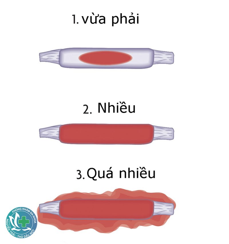 hút thai 5 tuần có đau không - Sự khác biệt về cảm giác đau sau thủ thuật hút thai 5 tuần có đau không - Sự khác biệt về cảm giác đau sau thủ thuật