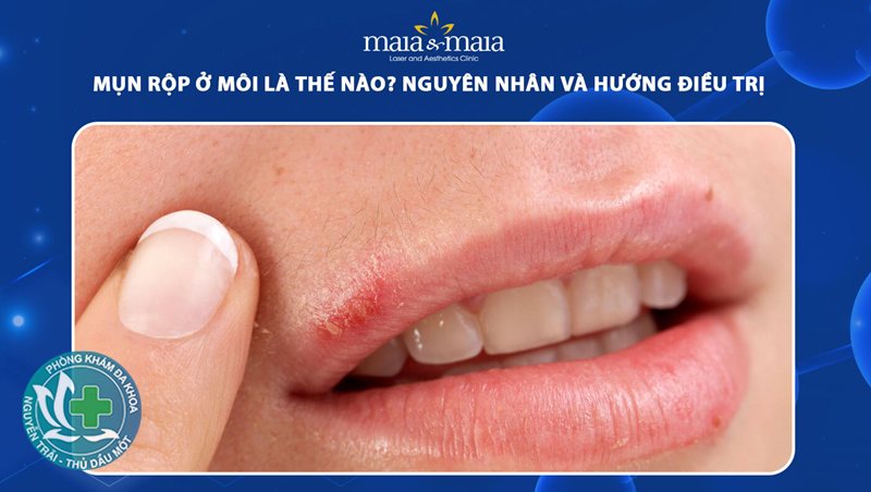 mụn rộp sinh dục ở nam - Mụn nước nhỏ kèm cảm giác ngứa rát