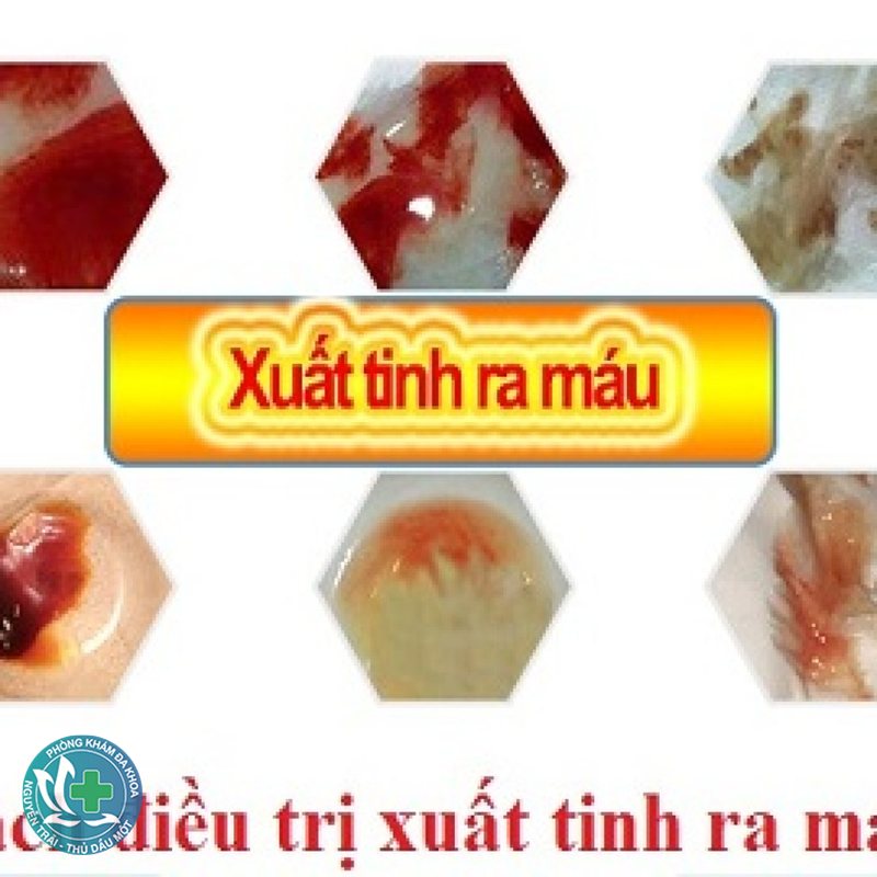 nguyên nhân rối loạn cương dương - Nguyên nhân tâm lý gây rối loạn cương dương nguyên nhân rối loạn cương dương - Nguyên nhân tâm lý gây rối loạn cương dương