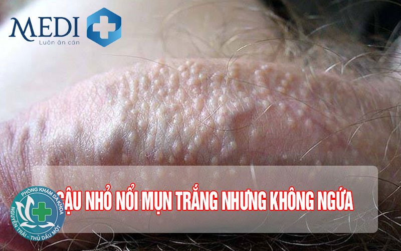 rối loạn cương dương là gì - Nguyên nhân tâm lý rối loạn cương dương là gì - Nguyên nhân tâm lý