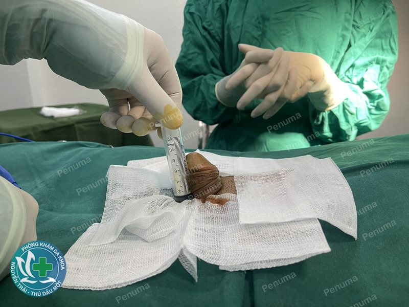 tinh trùng yếu nên ăn gì - Thực phẩm giàu chất chống oxy hóa tinh trùng yếu nên ăn gì - Thực phẩm giàu chất chống oxy hóa