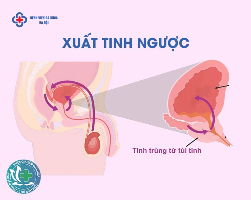 tinh trùng yếu nên ăn gì - Rượu bia và thuốc lá tinh trùng yếu nên ăn gì - Rượu bia và thuốc lá
