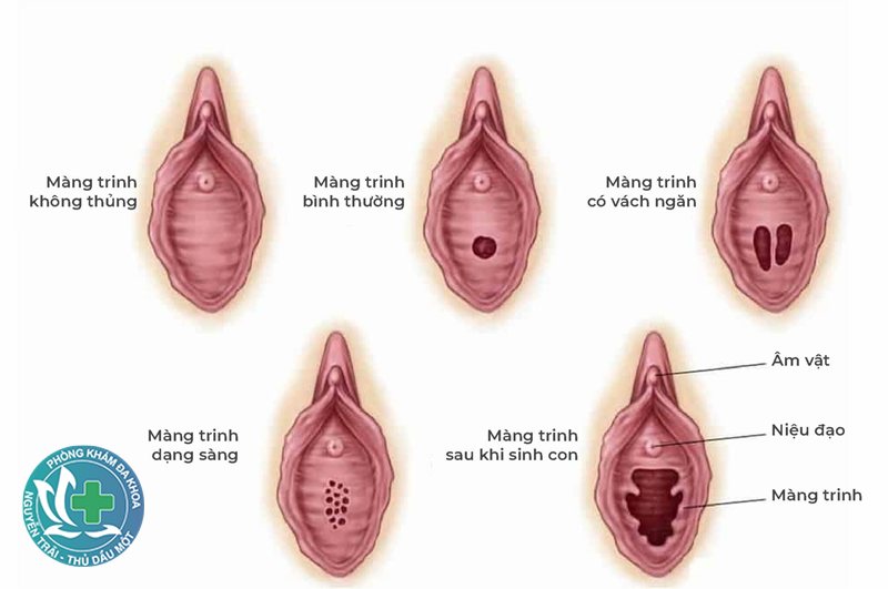 u nang buồng trứng có nguy hiểm không - Xoắn nang buồng trứng u nang buồng trứng có nguy hiểm không - Xoắn nang buồng trứng