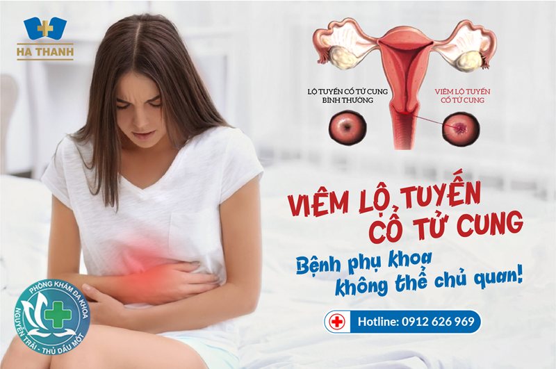 u nang buồng trứng có phải mổ không