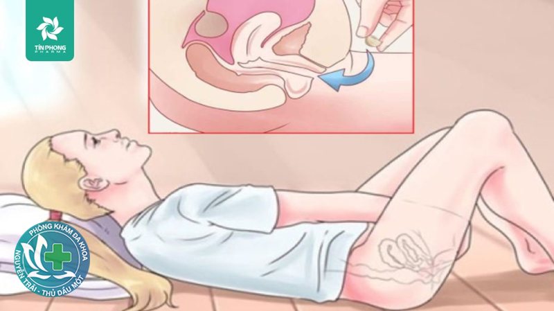 viêm phụ khoa tái đi tái lại viêm phụ khoa tái đi tái lại