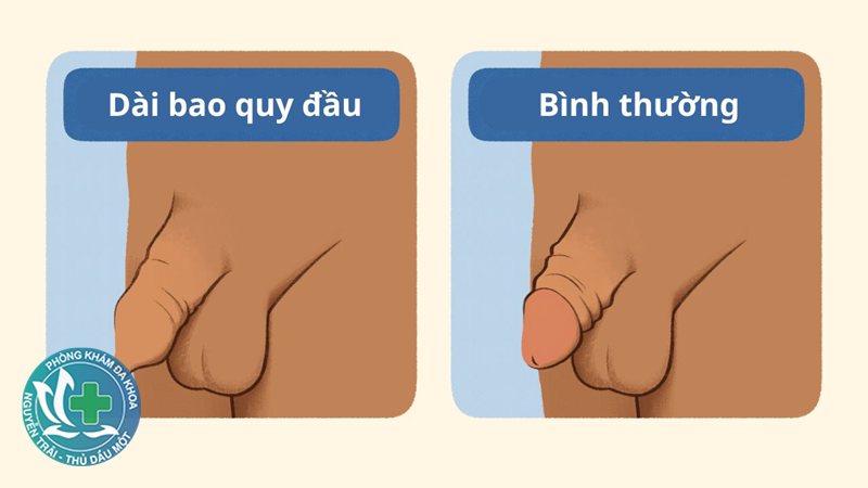 xuất tinh sớm có bị vô sinh không - Xuất tinh sớm nghiêm trọng gây khó khăn khi quan hệ xuất tinh sớm có bị vô sinh không - Xuất tinh sớm nghiêm trọng gây khó khăn khi quan hệ