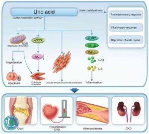 acid uric 1