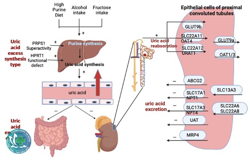 Acid uric - Khi nào cần thuốc hạ urate? Acid uric - Khi nào cần thuốc hạ urate?