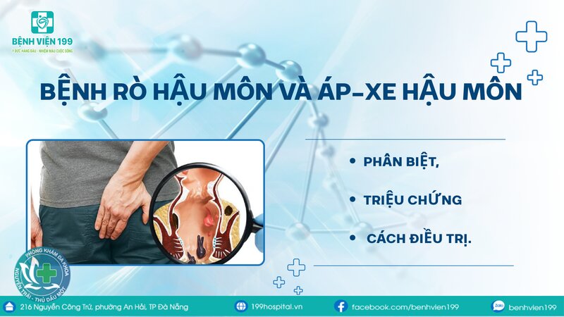 áp xe hậu môn có nguy hiểm không - Bản chất là một ổ nhiễm trùng có mủ áp xe hậu môn có nguy hiểm không - Bản chất là một ổ nhiễm trùng có mủ