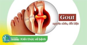 benh gout 1