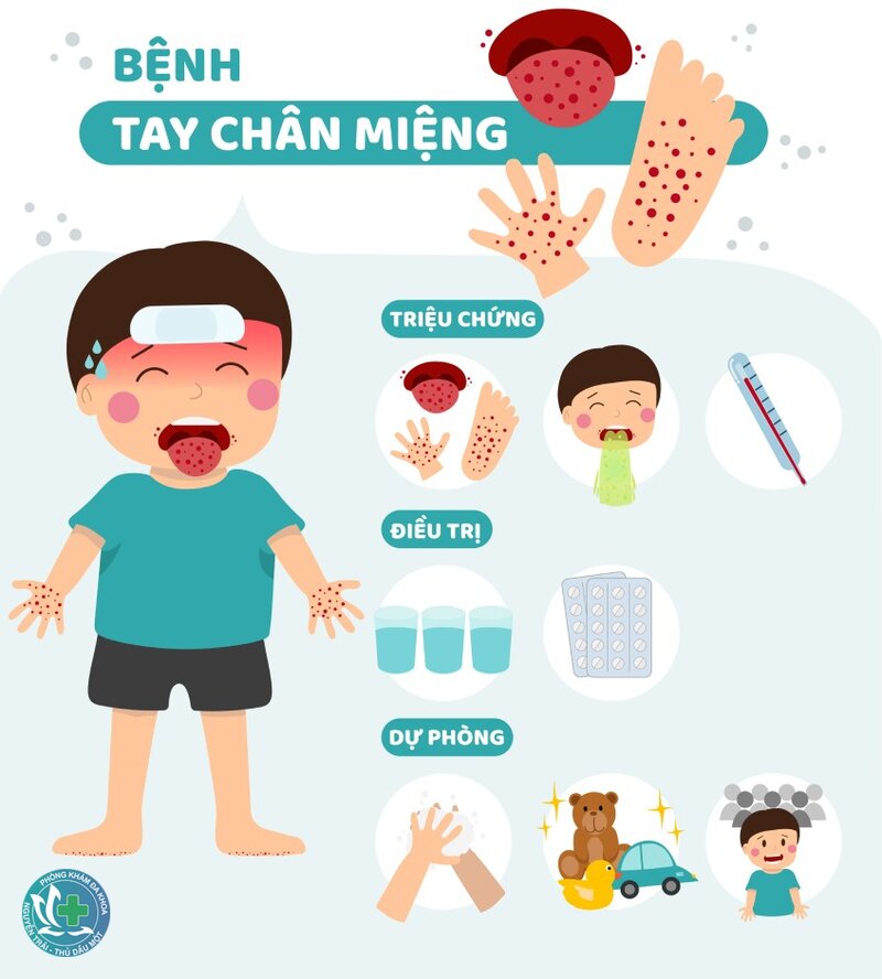 Bệnh tay chân miệng - Chăm sóc tại nhà Bệnh tay chân miệng - Chăm sóc tại nhà