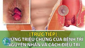 benh tri co nguy hiem khong 1