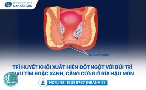 benh tri co tu khoi khong 1