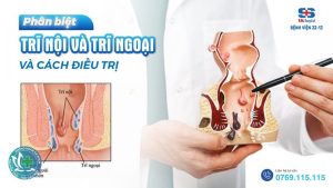 benh tri la gi 1