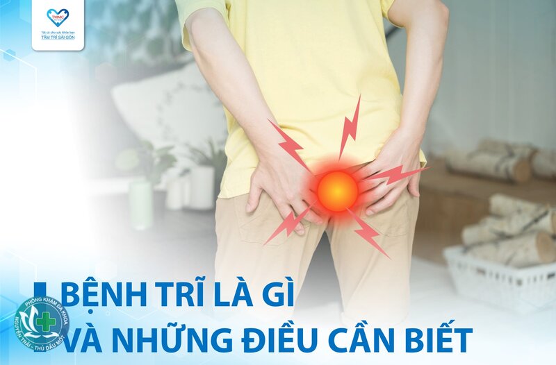 bệnh trĩ là gì - Định nghĩa bệnh trĩ là gì theo y khoa bệnh trĩ là gì - Định nghĩa bệnh trĩ là gì theo y khoa