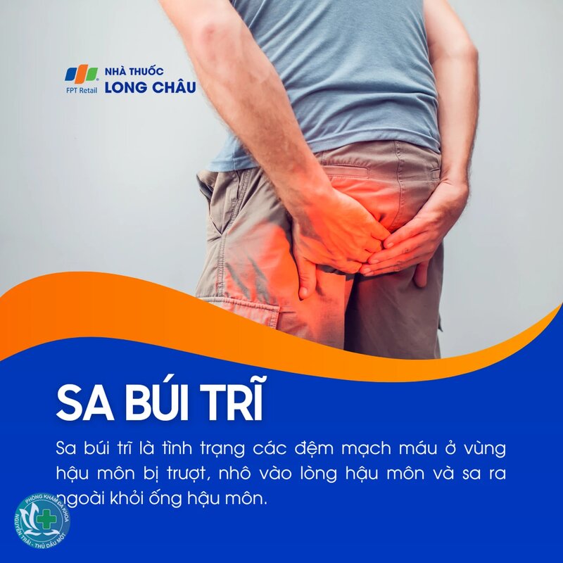 Búi trĩ là gì - Búi trĩ hình thành như thế nào? Búi trĩ là gì - Búi trĩ hình thành như thế nào?