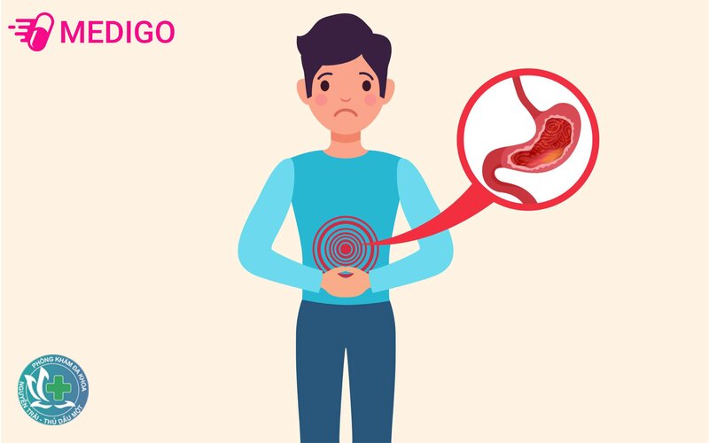 Đau dạ dày - Cách chăm sóc khi triệu chứng nhẹ