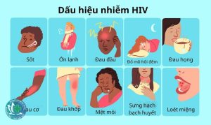 dau hieu hiv 1