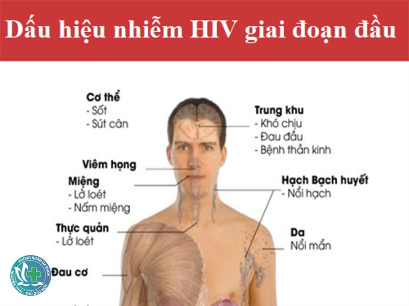 Dấu hiệu HIV - Giai đoạn không triệu chứng Dấu hiệu HIV - Giai đoạn không triệu chứng
