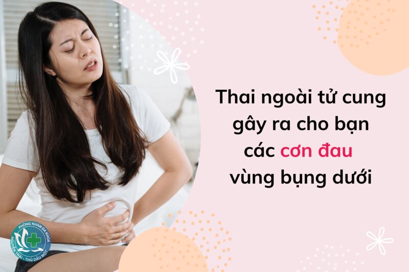 dấu hiệu mang thai ngoài tử cung - Thai ngoài tử cung là gì, thường nằm ở đâu dấu hiệu mang thai ngoài tử cung - Thai ngoài tử cung là gì, thường nằm ở đâu