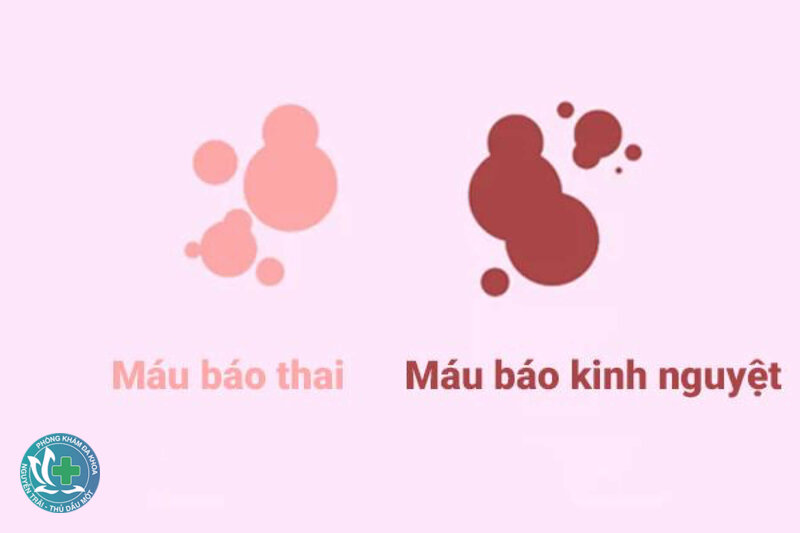 dấu hiệu mang thai sớm - Mệt mỏi, buồn ngủ bất thường dấu hiệu mang thai sớm - Mệt mỏi, buồn ngủ bất thường