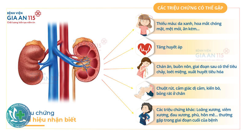Dấu hiệu suy thận - Xét nghiệm nào giúp phát hiện?