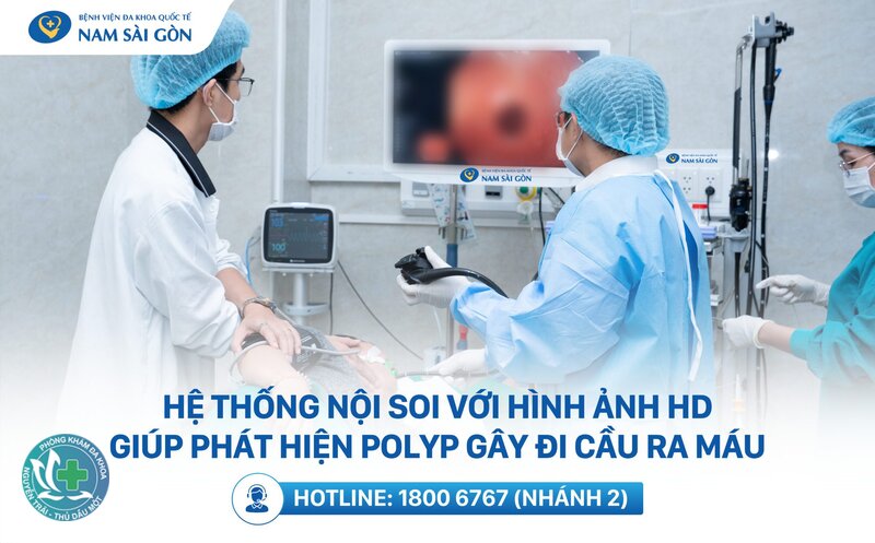 đi ngoài ra máu nhưng không đau - Polyp đại trực tràng đi ngoài ra máu nhưng không đau - Polyp đại trực tràng