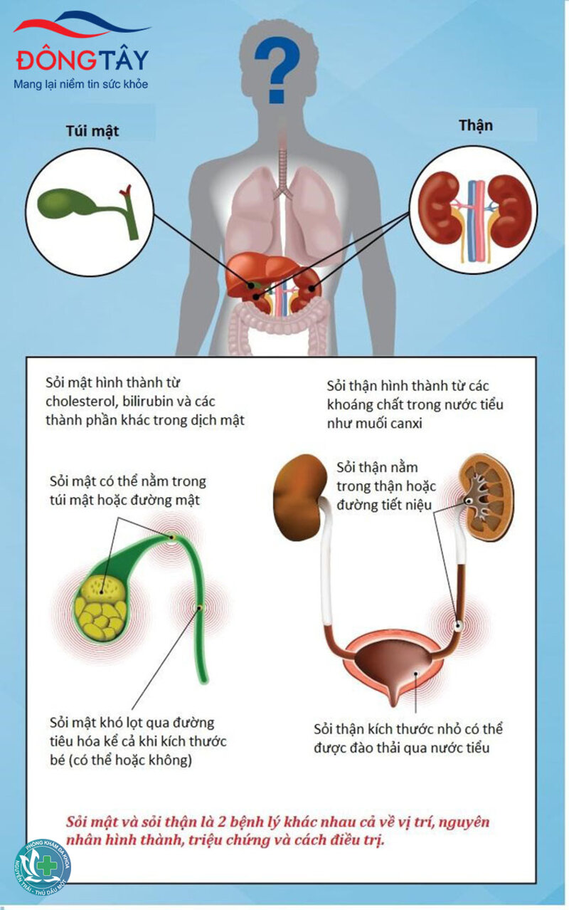 Nguyên nhân sỏi thận - Bệnh lý và di truyền liên quan Nguyên nhân sỏi thận - Bệnh lý và di truyền liên quan