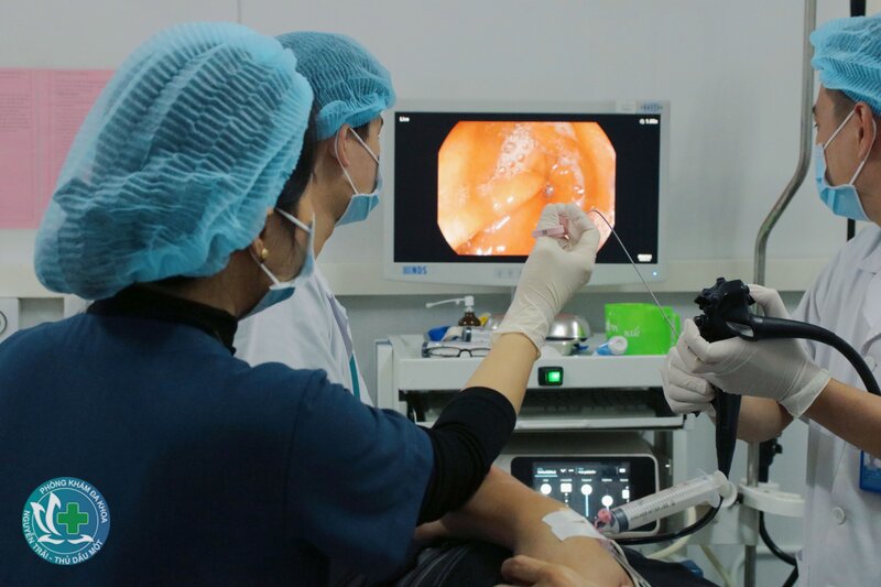 Nội soi dạ dày - Nội soi dạ dày có tác dụng gì? Nội soi dạ dày - Nội soi dạ dày có tác dụng gì?