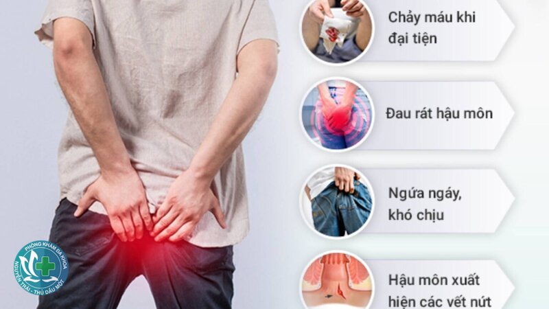 nứt kẽ hậu môn là gì - Nứt kẽ hậu môn là gì theo cách hiểu đơn giản nứt kẽ hậu môn là gì - Nứt kẽ hậu môn là gì theo cách hiểu đơn giản