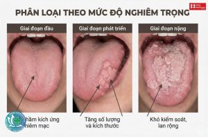 sui mao ga lay qua duong nao 1