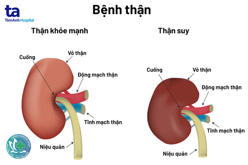 Suy thận - Thận làm những công việc gì?