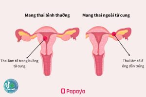 thai ngoai tu cung la gi 1